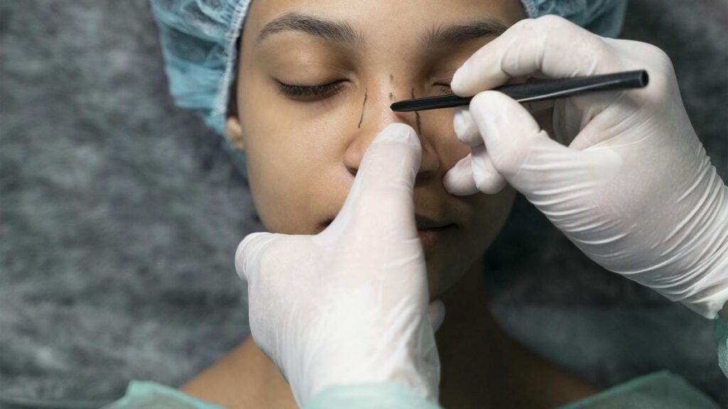 çankaya rinoplasti nedir